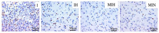 Active Caspase 3 Antibody in Immunohistochemistry (IHC)