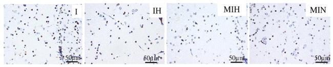 Active Caspase 3 Antibody in Immunohistochemistry (IHC)