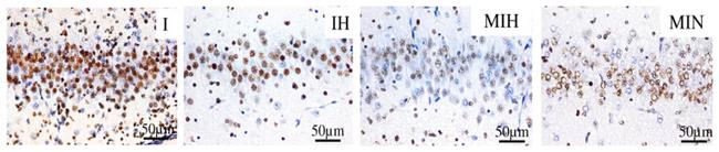 Active Caspase 3 Antibody in Immunohistochemistry (IHC)