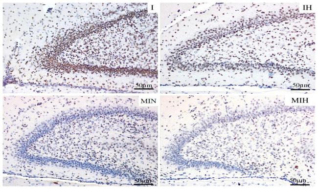 Active Caspase 3 Antibody in Immunohistochemistry (IHC)