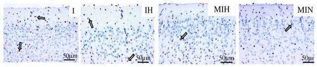 Active Caspase 3 Antibody in Immunohistochemistry (IHC)