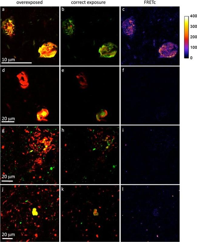 Mouse IgG1 Cross-Adsorbed Secondary Antibody in Immunohistochemistry (IHC)