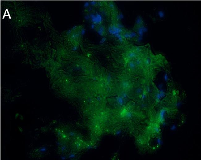 Mouse IgG (H+L) Cross-Adsorbed Secondary Antibody in Immunohistochemistry (Frozen) (IHC (F))