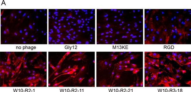 Rabbit IgG (H+L) Highly Cross-Adsorbed Secondary Antibody in Immunocytochemistry (ICC/IF)