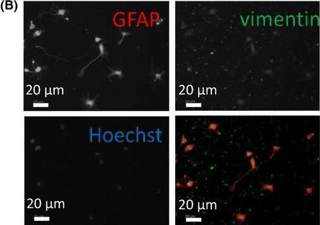 Mouse IgG (H+L) Cross-Adsorbed Secondary Antibody in Immunocytochemistry (ICC/IF)