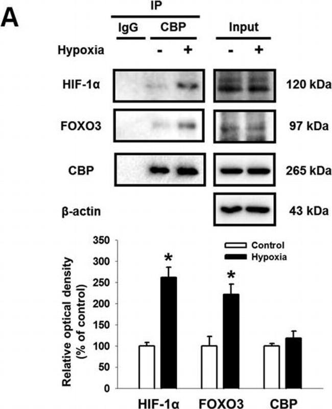 Rabbit IgG (H+L) Secondary Antibody in Western Blot (WB)