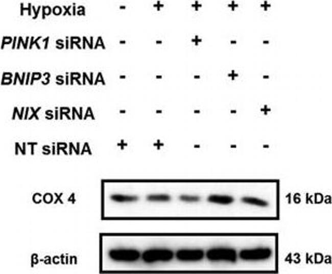 Mouse IgG (H+L) Secondary Antibody in Western Blot (WB)