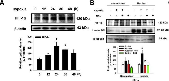 Rabbit IgG (H+L) Secondary Antibody in Western Blot (WB)