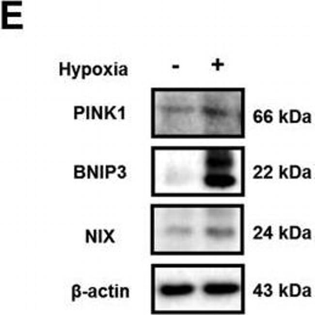 Rabbit IgG (H+L) Secondary Antibody in Western Blot (WB)