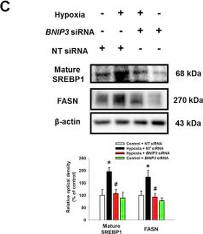 Rabbit IgG (H+L) Secondary Antibody in Western Blot (WB)