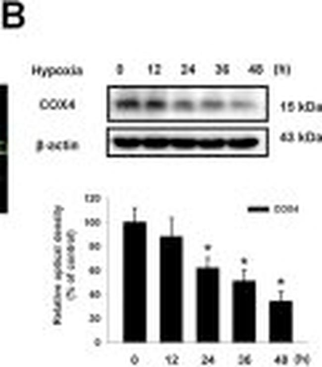 Mouse IgG (H+L) Secondary Antibody in Western Blot (WB)