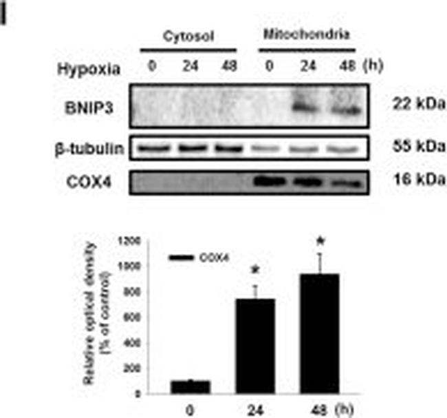 Mouse IgG (H+L) Secondary Antibody in Western Blot (WB)