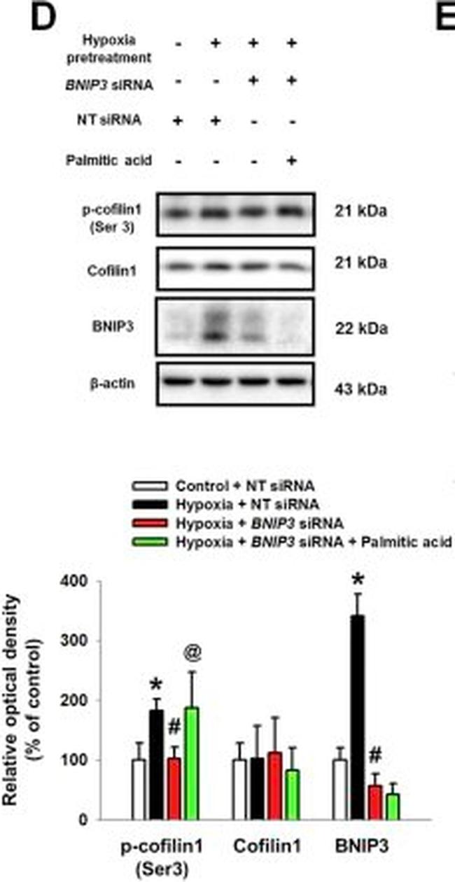 Rabbit IgG (H+L) Secondary Antibody in Western Blot (WB)