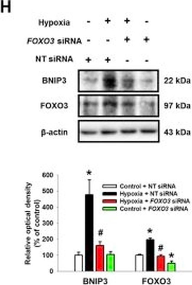 Rabbit IgG (H+L) Secondary Antibody in Western Blot (WB)