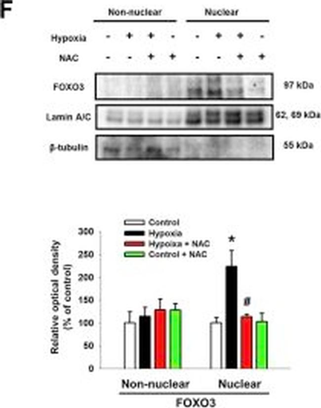 Rabbit IgG (H+L) Secondary Antibody in Western Blot (WB)