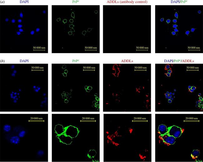 Rabbit IgG (H+L) Highly Cross-Adsorbed Secondary Antibody in Immunocytochemistry (ICC/IF)