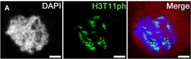 Guinea Pig IgG (H+L) Highly Cross-Adsorbed Secondary Antibody in Immunocytochemistry (ICC/IF)