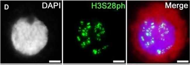 Guinea Pig IgG (H+L) Highly Cross-Adsorbed Secondary Antibody in Immunocytochemistry (ICC/IF)