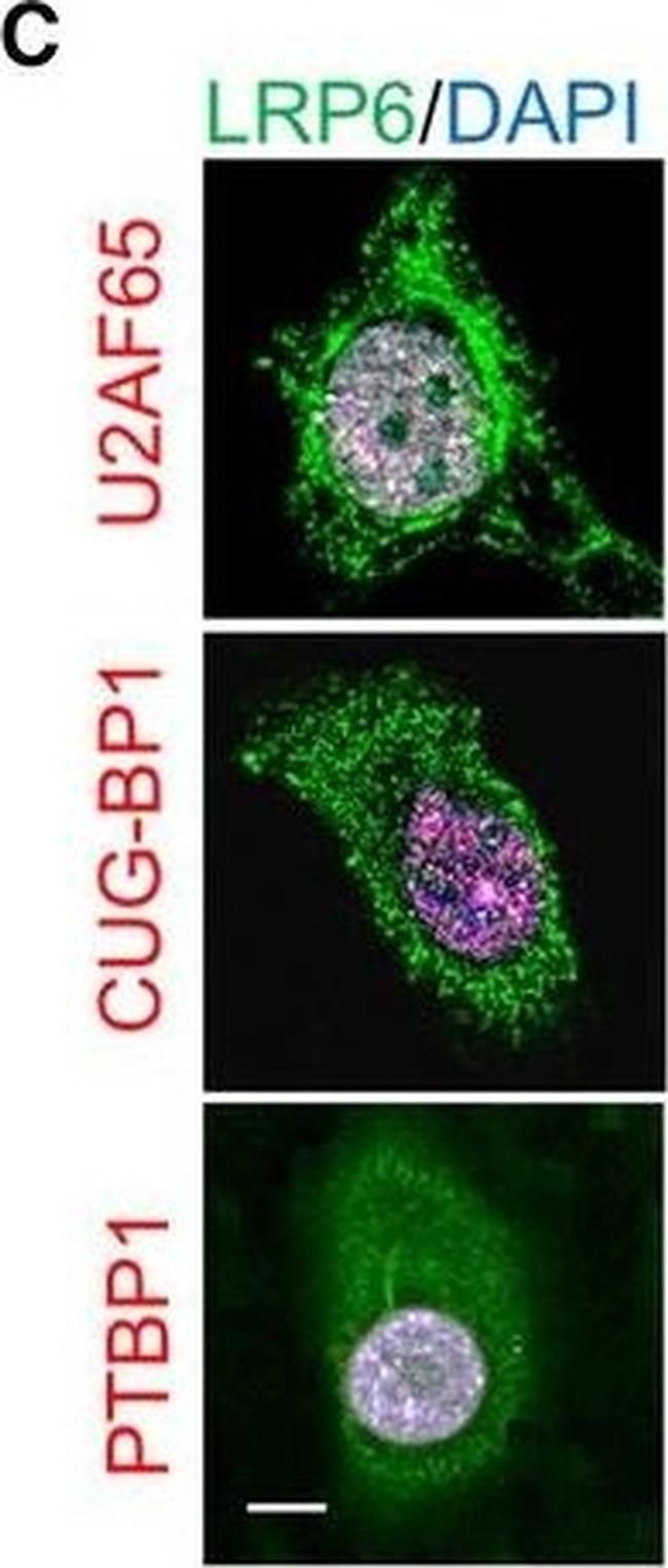 Rabbit IgG (H+L) Cross-Adsorbed Secondary Antibody in Immunocytochemistry (ICC/IF)