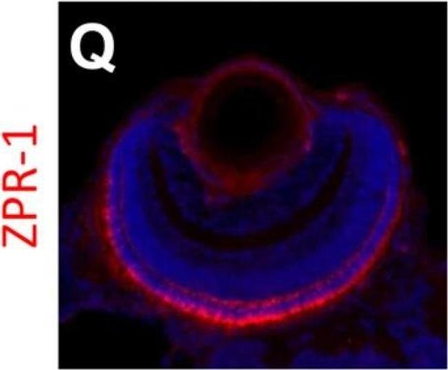 Mouse IgG2a Cross-Adsorbed Secondary Antibody in Immunohistochemistry (IHC)