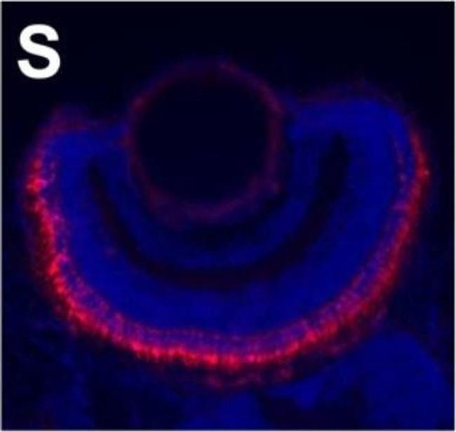 Mouse IgG2a Cross-Adsorbed Secondary Antibody in Immunohistochemistry (IHC)