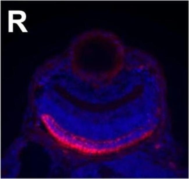 Mouse IgG2a Cross-Adsorbed Secondary Antibody in Immunohistochemistry (IHC)