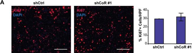 Rabbit IgG (H+L) Cross-Adsorbed Secondary Antibody in Immunohistochemistry (IHC)