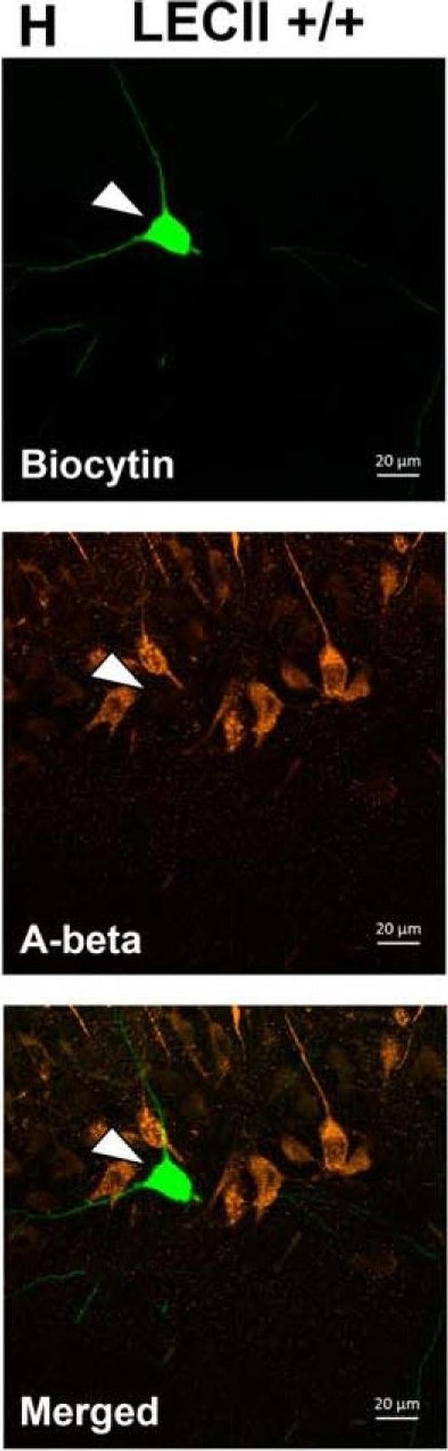 Mouse IgG (H+L) Cross-Adsorbed Secondary Antibody in Immunocytochemistry (ICC/IF)