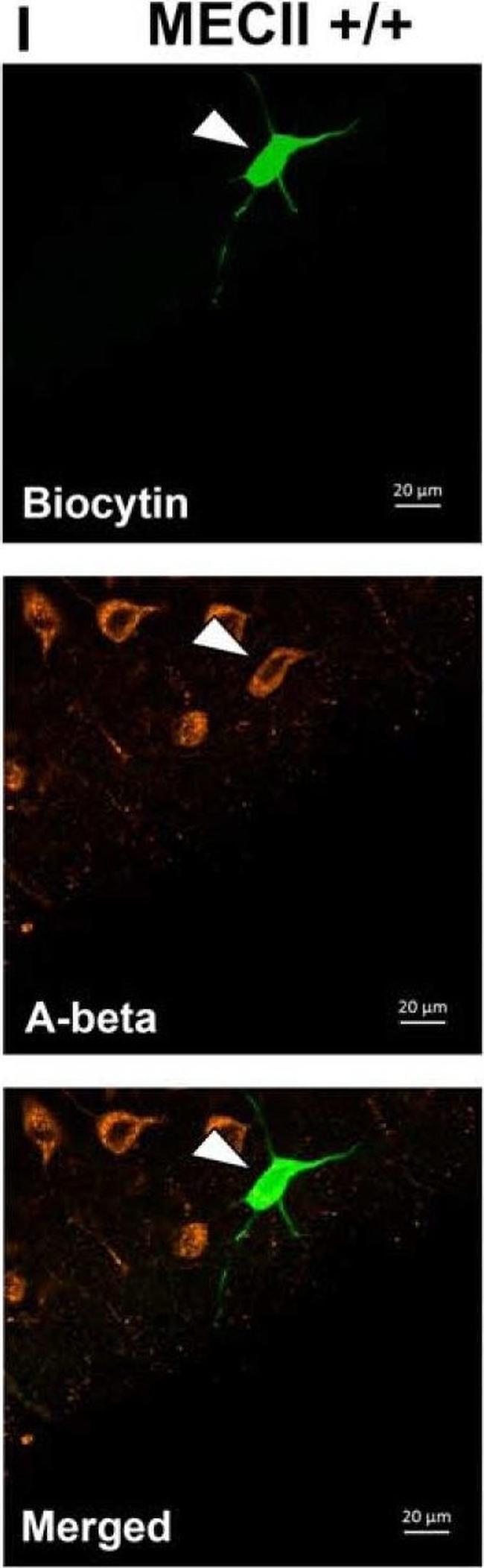 Mouse IgG (H+L) Cross-Adsorbed Secondary Antibody in Immunocytochemistry (ICC/IF)