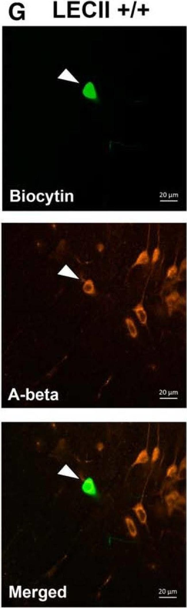 Mouse IgG (H+L) Cross-Adsorbed Secondary Antibody in Immunocytochemistry (ICC/IF)