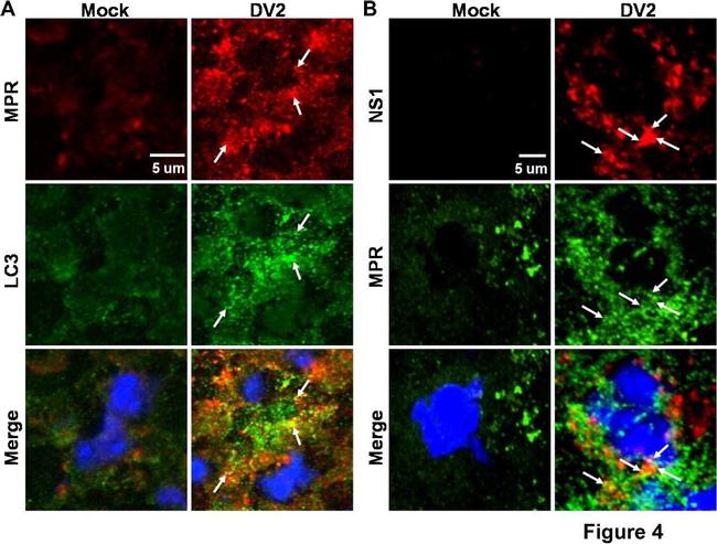 Mouse IgG (H+L) Cross-Adsorbed Secondary Antibody in Immunohistochemistry (IHC)