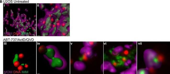 Mouse IgG (H+L) Cross-Adsorbed Secondary Antibody in Immunocytochemistry (ICC/IF)