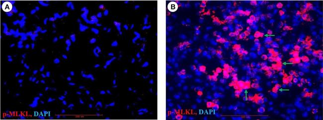 Mouse IgG (H+L) Cross-Adsorbed Secondary Antibody in Immunohistochemistry (IHC)