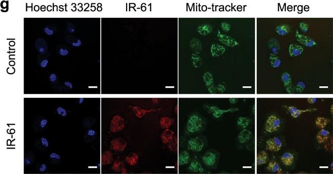 Rat IgG (H+L) Cross-Adsorbed Secondary Antibody in Immunocytochemistry (ICC/IF)