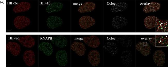 Rabbit IgG (H+L) Cross-Adsorbed Secondary Antibody in Immunocytochemistry (ICC/IF)