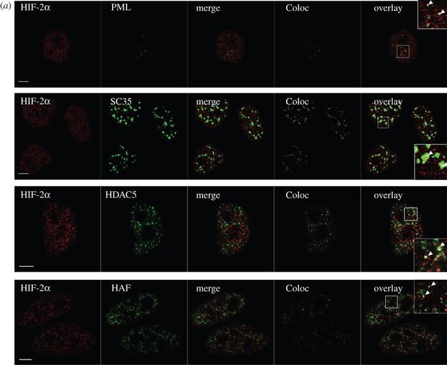 Rabbit IgG (H+L) Cross-Adsorbed Secondary Antibody in Immunocytochemistry (ICC/IF)