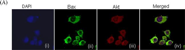 Rabbit IgG (H+L) Cross-Adsorbed Secondary Antibody in Immunocytochemistry (ICC/IF)