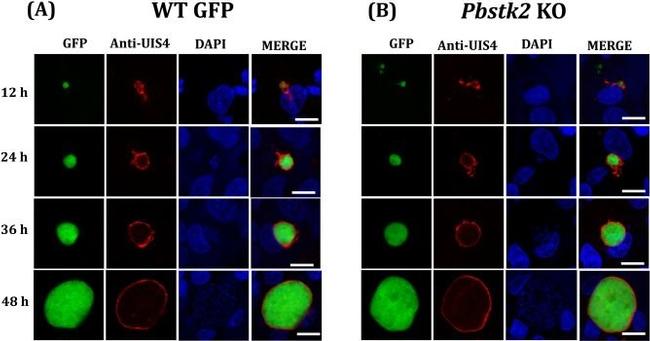 Rabbit IgG (H+L) Cross-Adsorbed Secondary Antibody in Immunocytochemistry (ICC/IF)