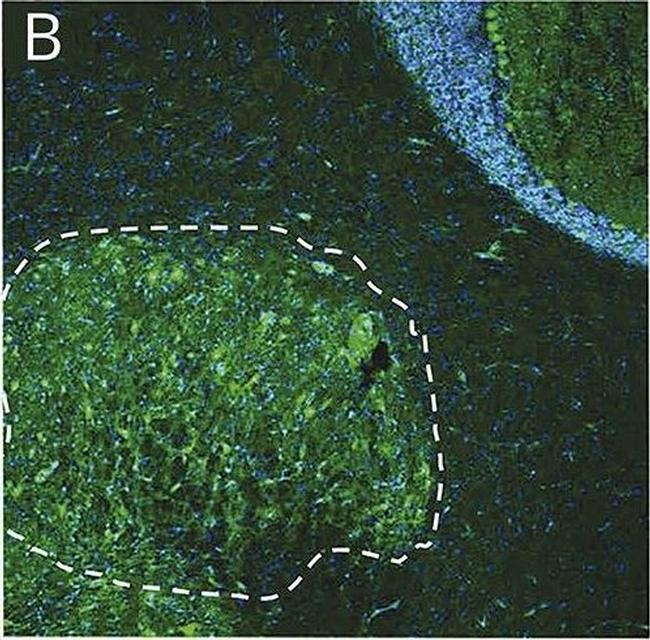 Human IgG (H+L) Cross-Adsorbed Secondary Antibody in Immunohistochemistry (Frozen) (IHC (F))