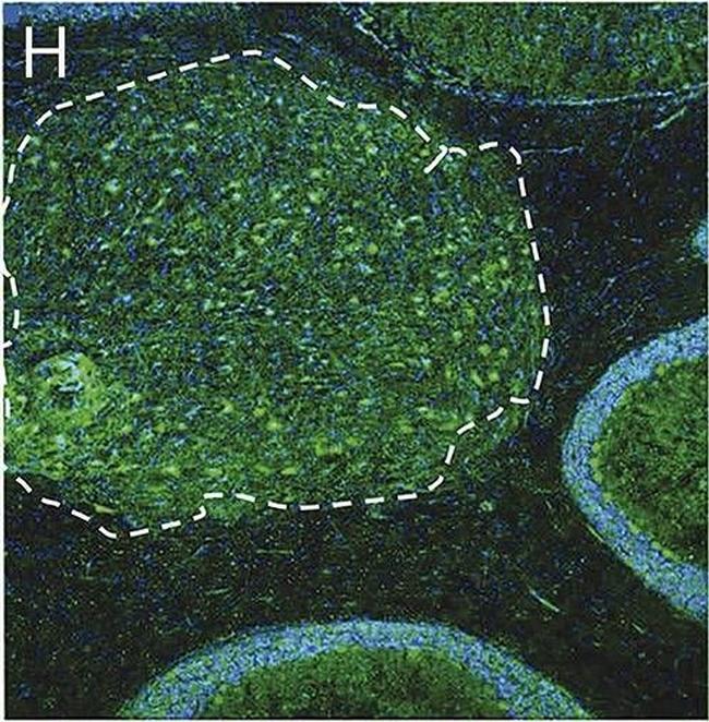 Human IgG (H+L) Cross-Adsorbed Secondary Antibody in Immunohistochemistry (Frozen) (IHC (F))