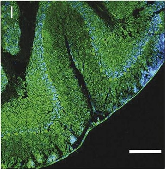 Human IgG (H+L) Cross-Adsorbed Secondary Antibody in Immunohistochemistry (Frozen) (IHC (F))