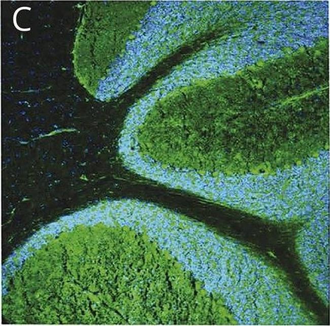 Human IgG (H+L) Cross-Adsorbed Secondary Antibody in Immunohistochemistry (Frozen) (IHC (F))