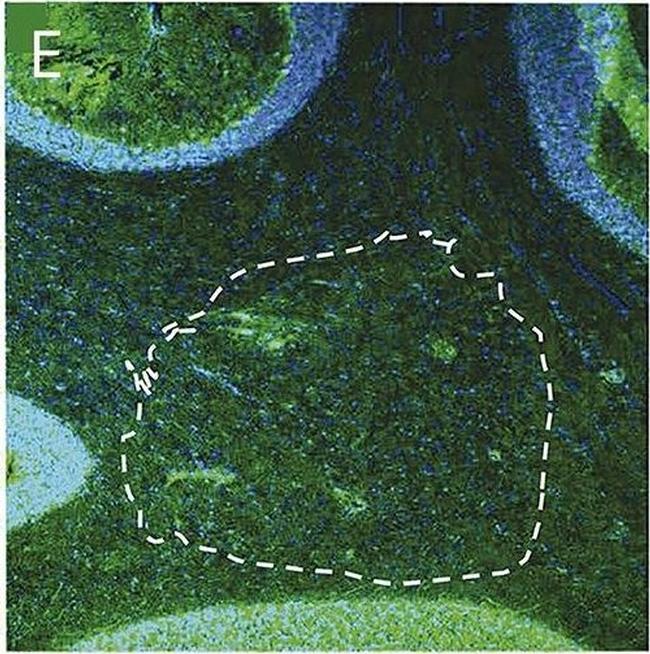 Human IgG (H+L) Cross-Adsorbed Secondary Antibody in Immunohistochemistry (Frozen) (IHC (F))