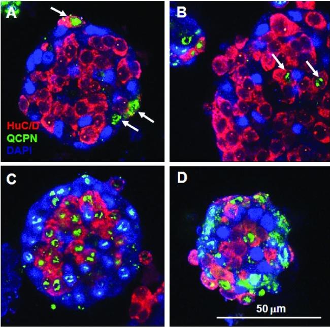 Mouse IgG (H+L) Highly Cross-Adsorbed Secondary Antibody in Immunocytochemistry (ICC/IF)