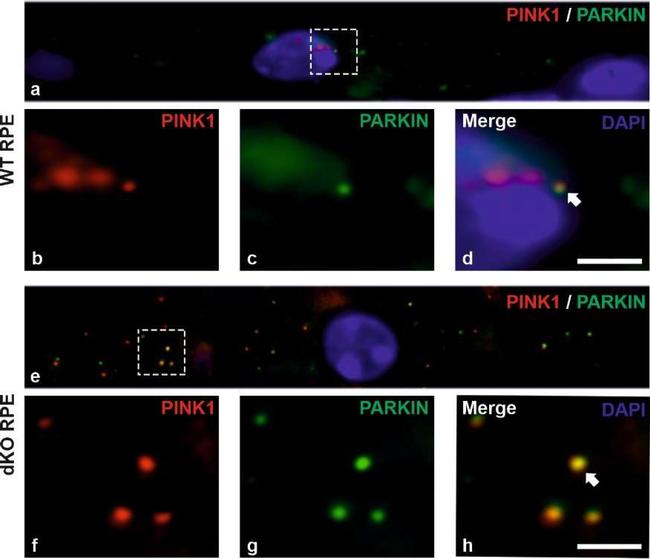 Mouse IgG (H+L) Highly Cross-Adsorbed Secondary Antibody in Immunohistochemistry (Paraffin) (IHC (P))