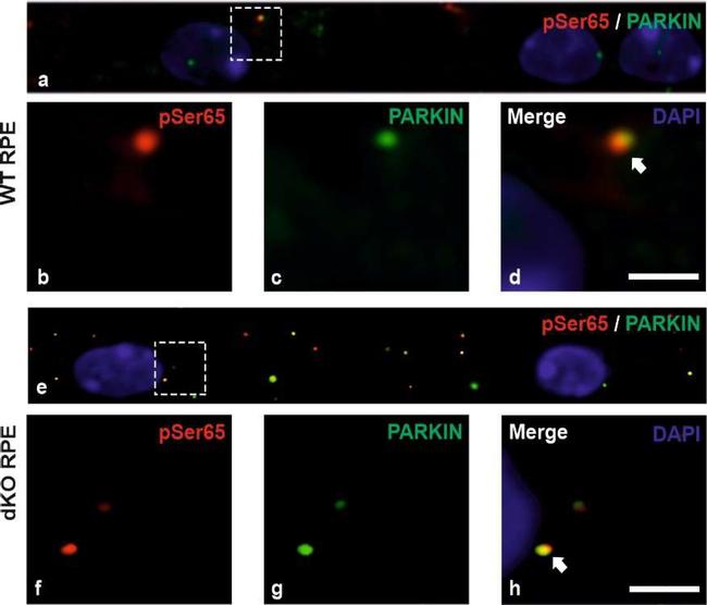 Mouse IgG (H+L) Highly Cross-Adsorbed Secondary Antibody in Immunohistochemistry (Paraffin) (IHC (P))