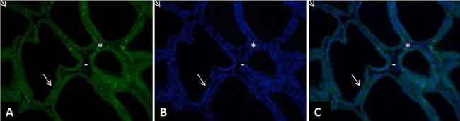 Mouse IgG (H+L) Highly Cross-Adsorbed Secondary Antibody in Immunohistochemistry (IHC)