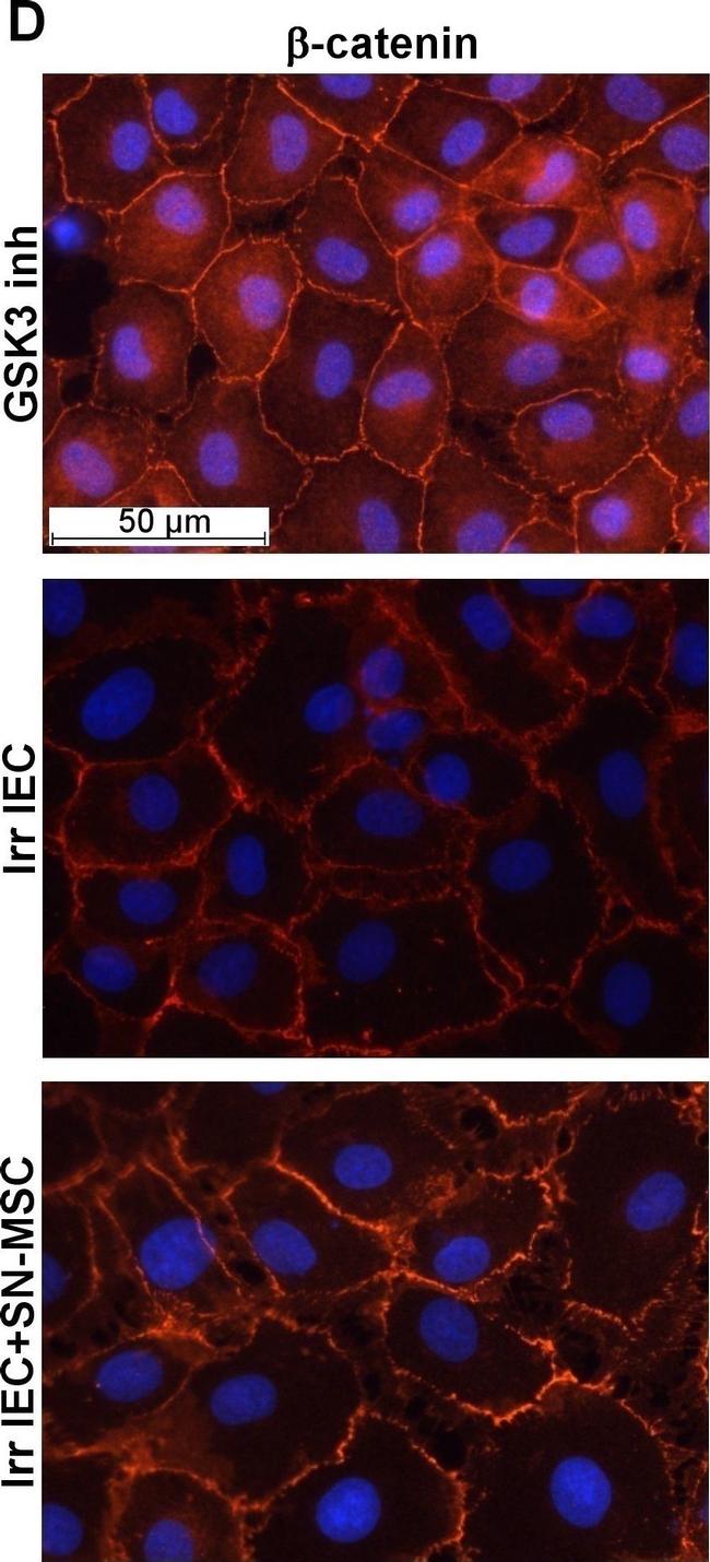 Rabbit IgG (H+L) Highly Cross-Adsorbed Secondary Antibody in Immunocytochemistry (ICC/IF)