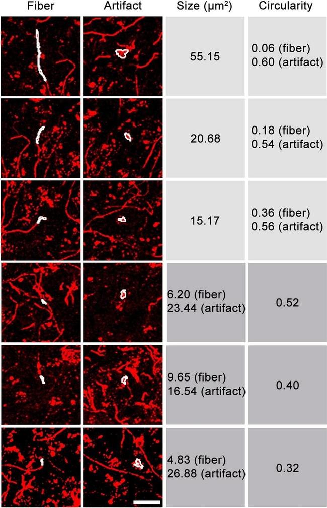 Rabbit IgG (H+L) Highly Cross-Adsorbed Secondary Antibody in Immunohistochemistry (IHC)