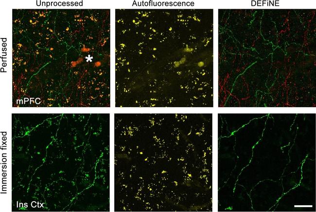 Rabbit IgG (H+L) Highly Cross-Adsorbed Secondary Antibody in Immunohistochemistry (IHC)